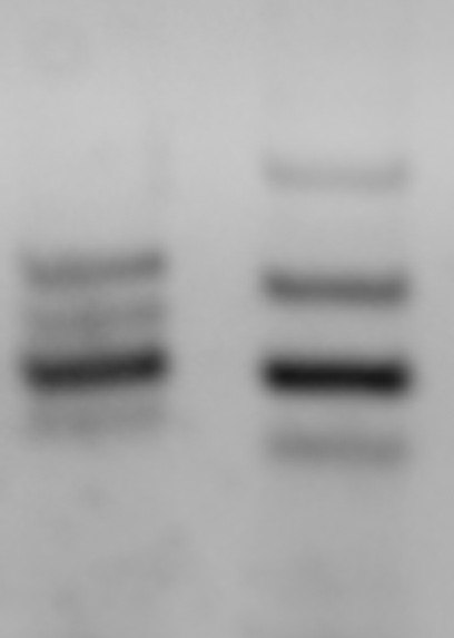 multiplex PCRの結果